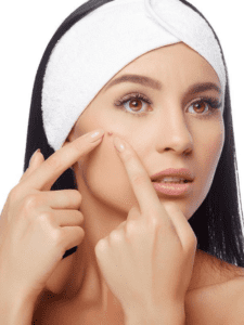 Treatment of pimples with homeopathic medicine